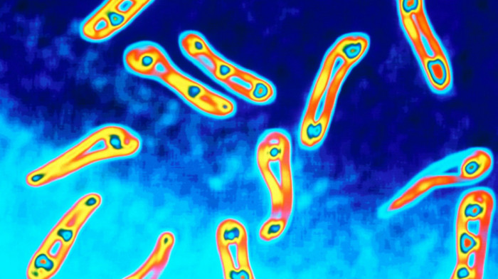 Prijavljen jedan smrtni slučaj od difterije u Austriji