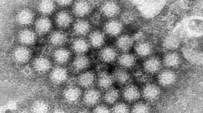 Norovirus se širi Italijom: Više od 300 ljudi hospitalizovano zbog stomačne infekcije