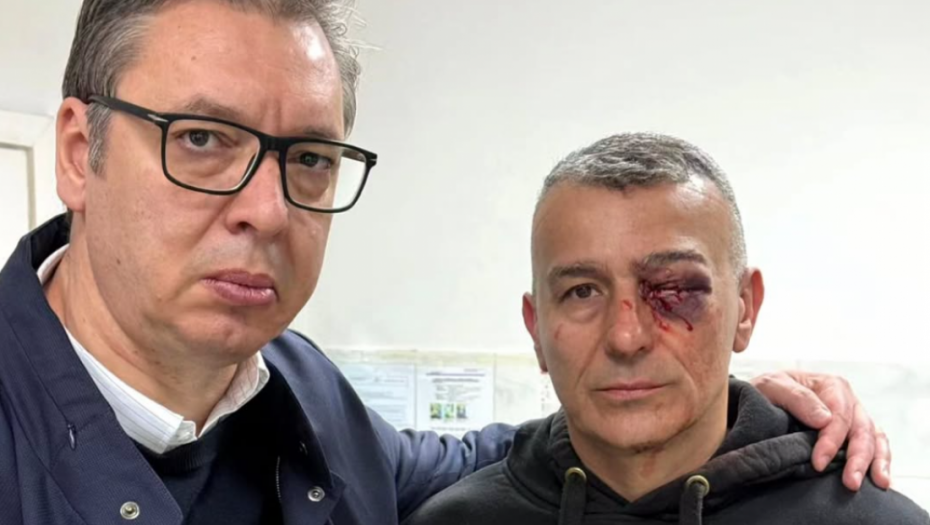 Predsednik Vučić obišao policajca koji je povređen ispred RTS-a: "Toliko o mirnim demonstrantima i nadasve ugroženim"